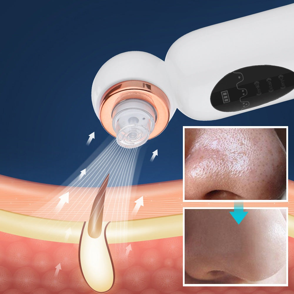 NOUVEAU RICHE Mitesserentferner und Hydrodermabrasion – Porenreiniger mit Vakuum & Hydrafacial Gerät für zu Hause, Wasser & Sauerstoff – HydraGlow