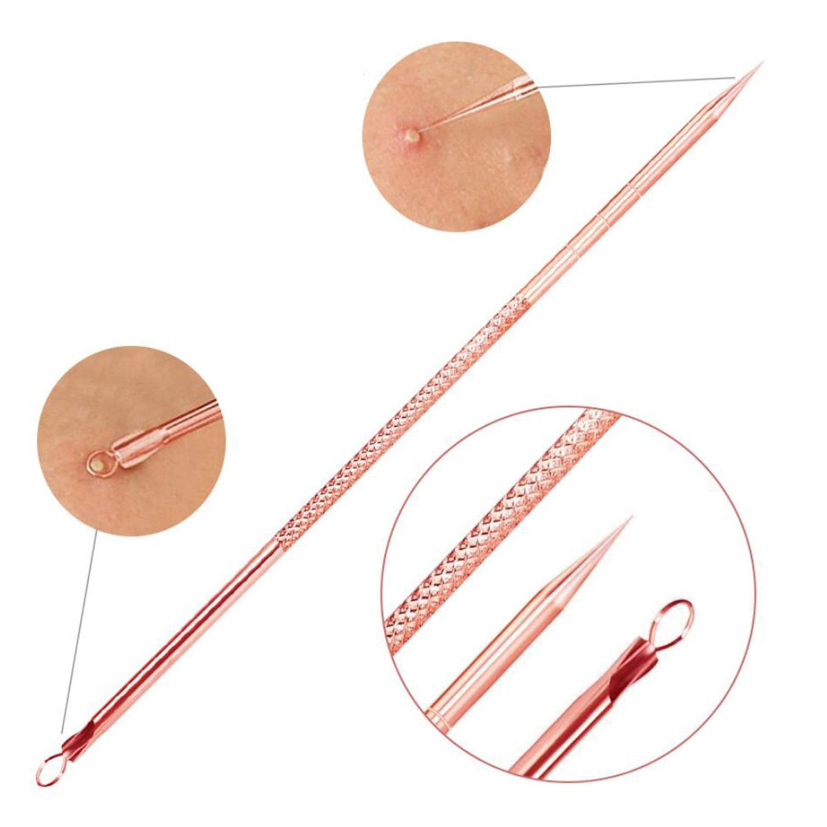 NOUVEAU RICHE Mitesser- und Pickelentferner-Set – Komedonenquetscher Set, Mitesserentferner Werkzeug mit Etui